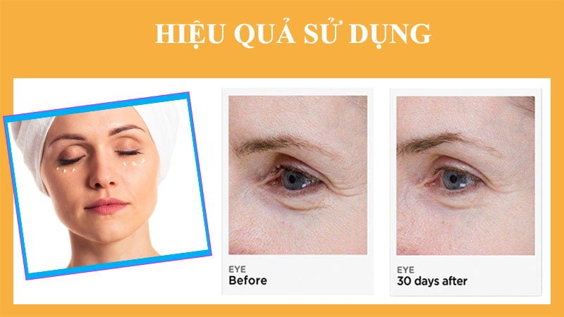 sử dụng  Kem Giảm Vùng Thâm Quanh Mắt Murad